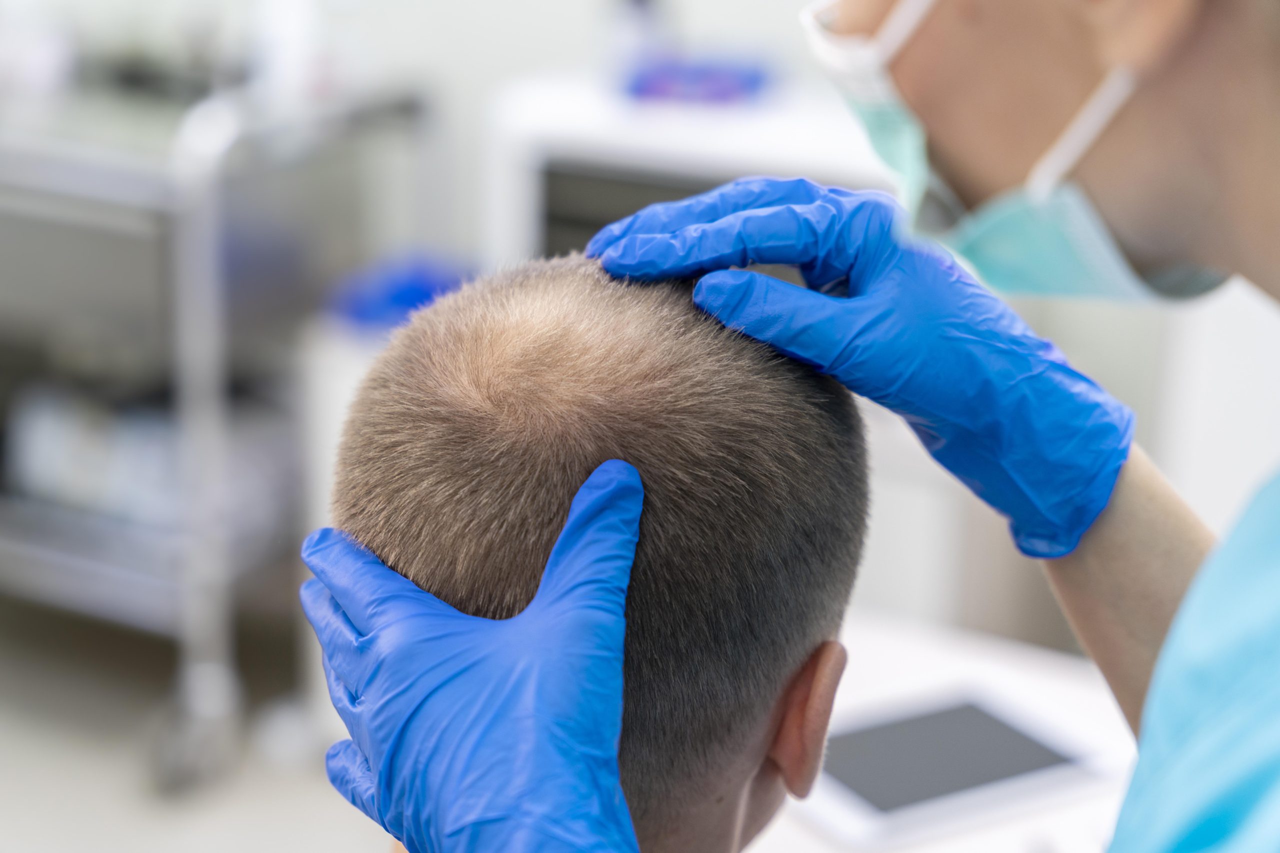 problemas sin pelo 